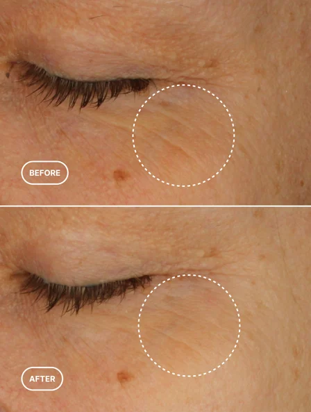 DSG Retinol Alternative Eye Serum