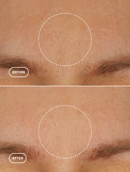 DSG Retinol Alternative Moisturizer